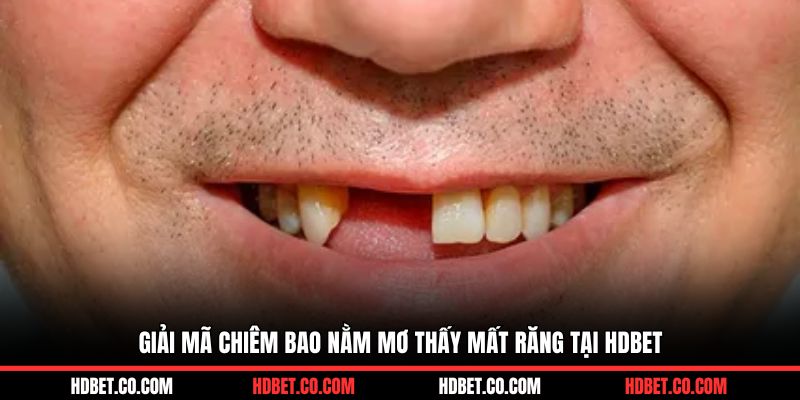 Giải mã chiêm bao nằm mơ thấy mất răng tại HDBET